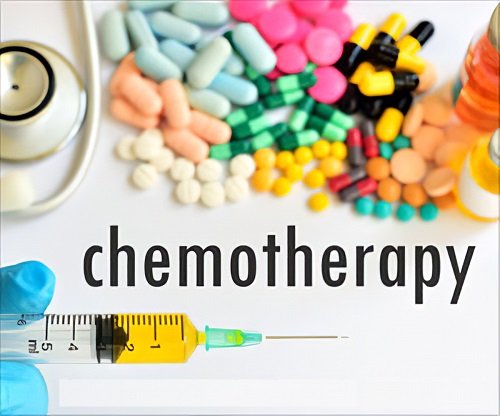 Chemotherapy